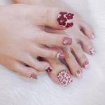 over the top toenails